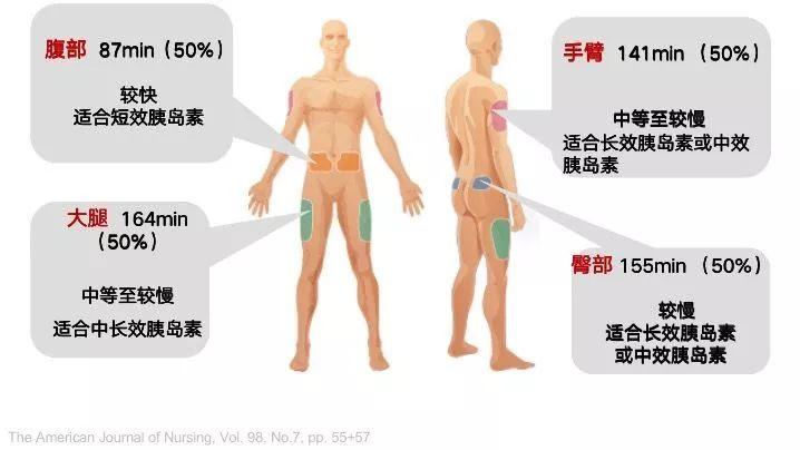 最新型胰岛素及其使用指南